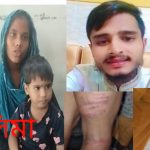 সোনারগাঁওয়ে স্বামী আকাশ ও শাশুড়ীর নির্যাতনের শিকার নাসিমা ; ন্যায় বিচারের আকুতি