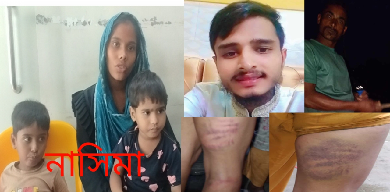সোনারগাঁওয়ে স্বামী আকাশ ও শাশুড়ীর নির্যাতনের শিকার নাসিমা ; ন্যায় বিচারের আকুতি