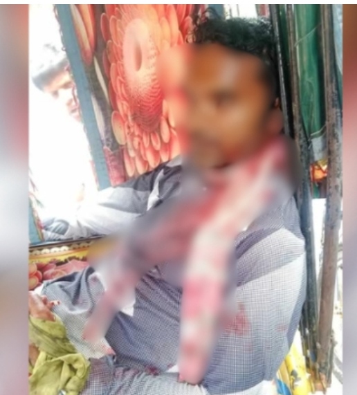 ফতুল্লায় যাত্রীবেশে অটোরিকশা চালকের গলা কেটে হত্যার চেষ্টা